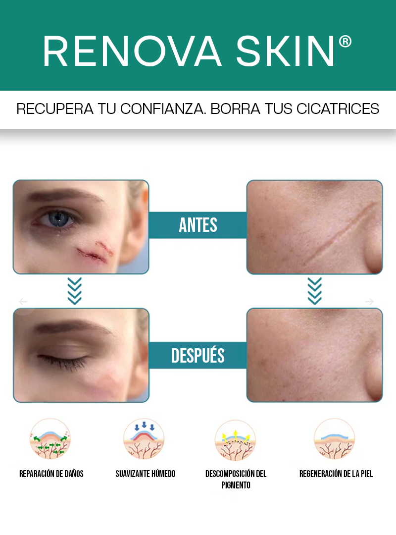 RENOVA SKIN® | CINTA DE SILICONA PARA QUITAR CICATRICES