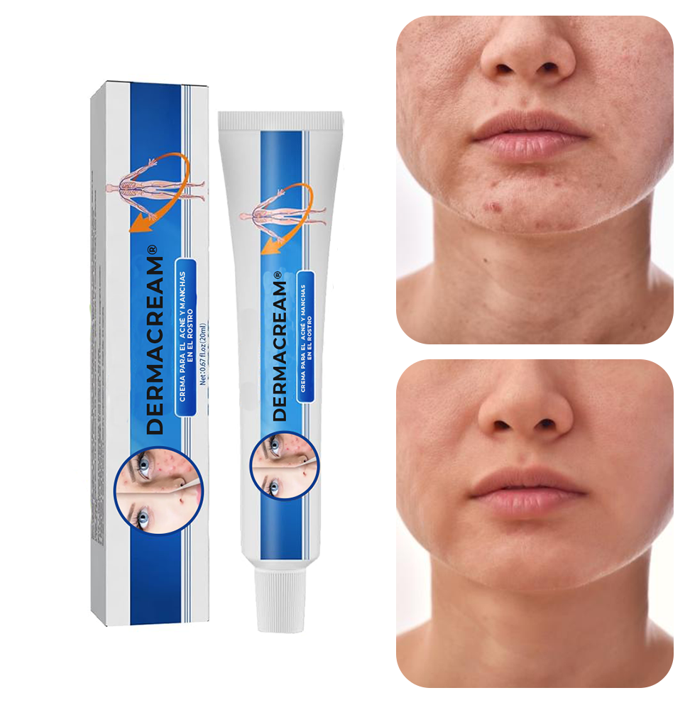 DERMACREAM®