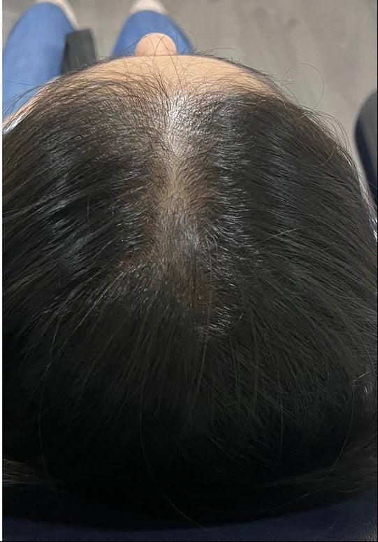 files/Alopecia_femenina_..La_alopecia_androgenica_femenina_es_multifactorial_es_decir_estan_implicad_d13d6612-19e7-44ea-9327-dbcaff43f566.jpg