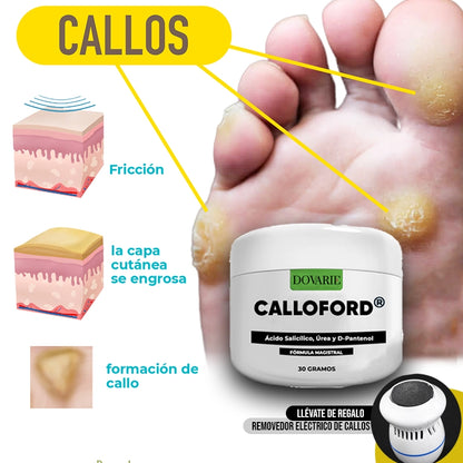CALLOFORD®