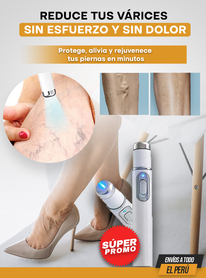 VARILÁSER® | Terapia láser antivárices