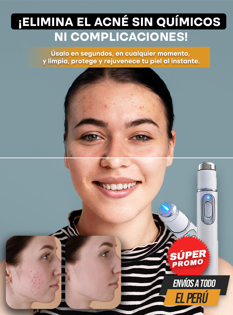 DERMABLUE® | TECNOLOGÍA LUZ AZUL PARA EL ACNÉ Y MANCHAS EN EL ROSTRO