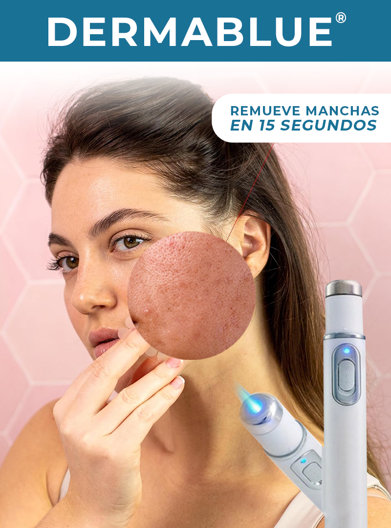 DERMABLUE® | TECNOLOGÍA LUZ AZUL PARA EL ACNÉ Y MANCHAS EN EL ROSTRO