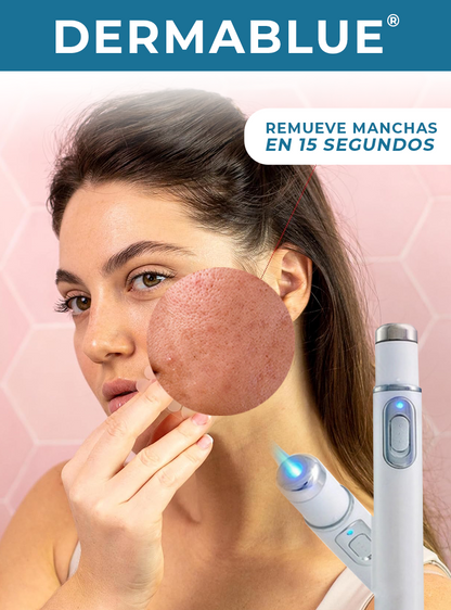 DERMABLUE® | TECNOLOGÍA LUZ AZUL PARA EL ACNÉ Y MANCHAS EN EL ROSTRO