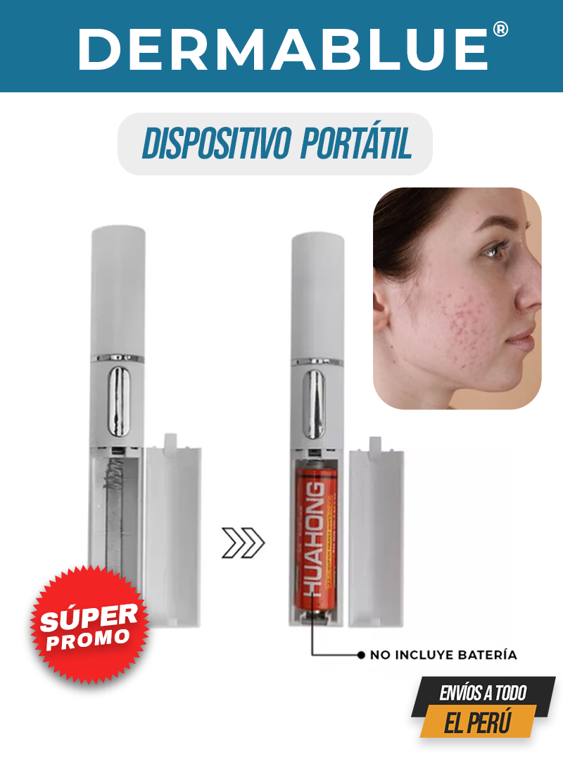 DERMABLUE® | TECNOLOGÍA LUZ AZUL PARA EL ACNÉ Y MANCHAS EN EL ROSTRO