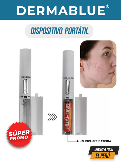 DERMABLUE® | TECNOLOGÍA LUZ AZUL PARA EL ACNÉ Y MANCHAS EN EL ROSTRO