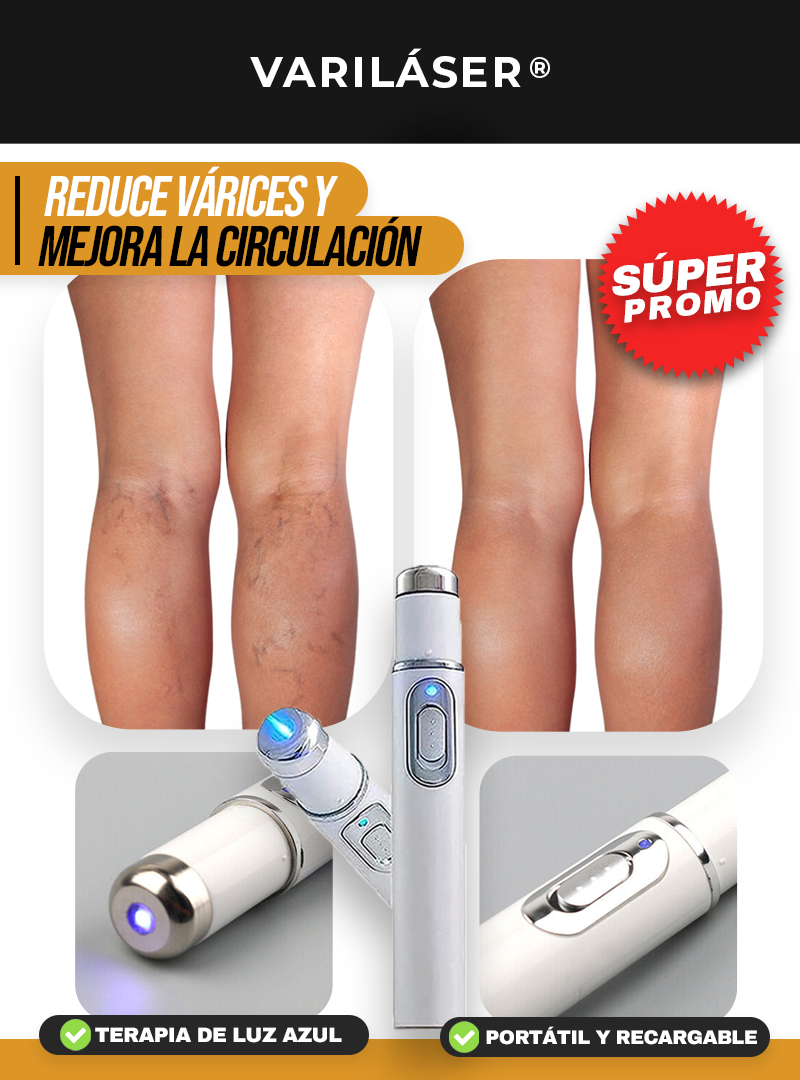 VARILÁSER® | Terapia láser antivárices