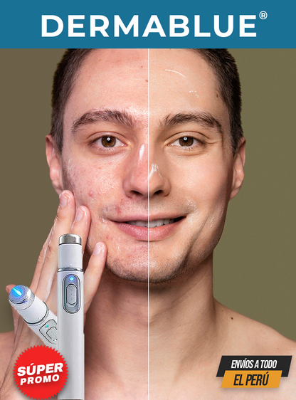 DERMABLUE® | TECNOLOGÍA LUZ AZUL PARA EL ACNÉ Y MANCHAS EN EL ROSTRO