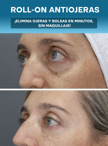 ROLL-ON ANTIOJERAS | Despierta tu mirada y borra los signos de cansancio