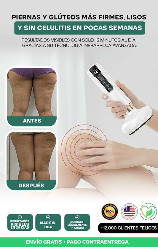 SlimNova® – Masajeador Anticelulitis Infrarrojo
